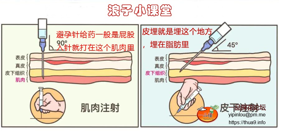 体内给药途径.jpg